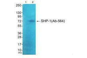 Western blot analysis of extracts from JK cells (Lane 2), using SHP-1 (Ab-564) antiobdy. (MSK1 抗体  (C-Term))