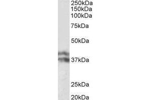Western Blotting (WB) image for anti-Haptoglobin (HP) (Internal Region) antibody (ABIN2464980) (Haptoglobin 抗体  (Internal Region))