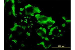 Immunofluorescence of monoclonal antibody to EIF4E2 on HeLa cell.