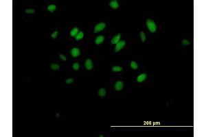 Immunofluorescence of purified MaxPab antibody to MXD3 on HeLa cell. (MXD3 抗体  (AA 1-206))