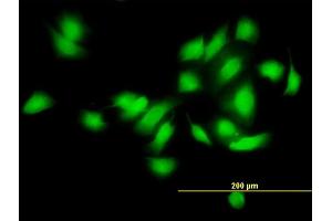 Immunofluorescence of monoclonal antibody to CAMK2A on HeLa cell. (CAMK2A 抗体  (AA 305-410))