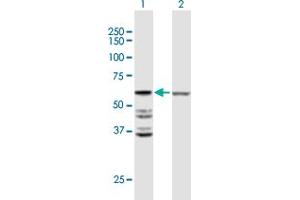 Western Blot analysis of ACOT2 expression in transfected 293T cell line by ACOT2 MaxPab polyclonal antibody. (ACOT2 抗体  (AA 1-483))