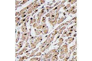 Immunohistochemical analysis of MAPKAPK3 staining in human heart formalin fixed paraffin embedded tissue section. (MAPKAP Kinase 3 抗体  (C-Term))