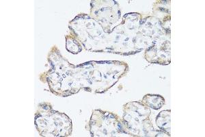 Immunohistochemistry (IHC) image for anti-Proto-oncogene tyrosine-protein kinase Src (Src) (AA 1-80) antibody (ABIN6148428)