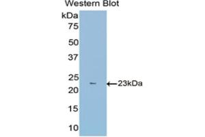 Detection of Recombinant FBLN1, Mouse using Polyclonal Antibody to Fibulin 1 (FBLN1) (Fibulin 1 抗体  (AA 399-578))