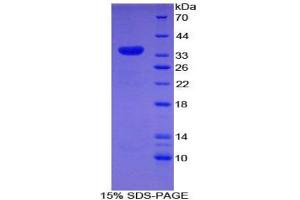 SDS-PAGE analysis of Rat Myosin ID Protein. (Myosin ID Protein (MYO1D))