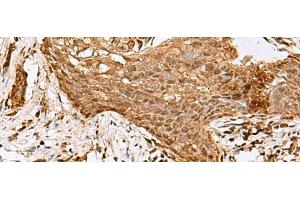 Immunohistochemistry (Paraffin-embedded Sections) (IHC (p)) image for anti-SAM Domain, SH3 Domain and Nuclear Localization Signals, 1 (SAMSN1) antibody (ABIN7247078)