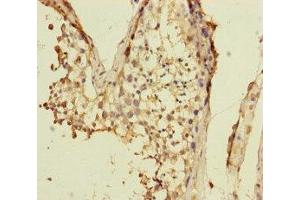 Immunohistochemistry of paraffin-embedded human testis tissue using ABIN7175313 at dilution of 1:100