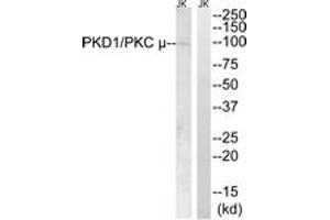 Western blot analysis of extracts from Jurkat cells, using PKD1/PKC mu (Ab-910) Antibody. (PKC mu 抗体  (AA 863-912))