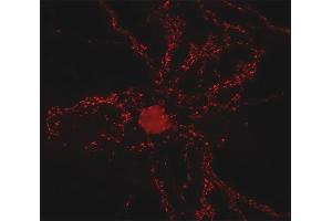 Indirect immunolabeling of cultured rat hippocampus neurons (dilution 1 : 500) (SYN2 抗体  (AA 440-458))