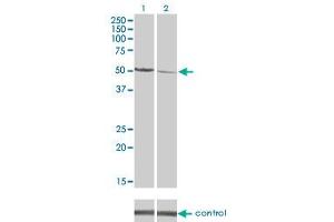 Western blot analysis of CAMK2D over-expressed 293 cell line, cotransfected with CAMK2D Validated Chimera RNAi (Lane 2) or non-transfected control (Lane 1). (CAMK2D 抗体  (AA 301-410))