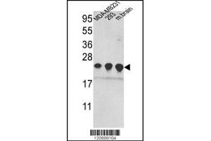 Western blot analysis of PRDX2 Antibody in MDA-MB231,293 cell line and mouse brain tissue lysates (35ug/lane)(2ug/ml) (Peroxiredoxin 2 抗体  (C-Term))