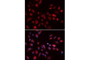 Immunofluorescence analysis of U2OS cells using CHRM5 antibody (ABIN5973103). (CHRM5 抗体)