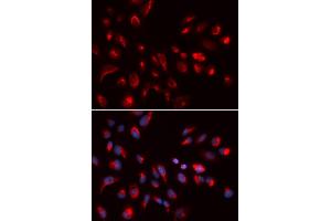 Immunofluorescence analysis of U2OS cells using CHRM5 antibody (ABIN5973103). (CHRM5 抗体)