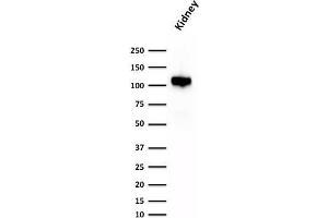 Western Blot Analysis of human Kidney lysate using KSP-Cadherin Rabbit Recombinant Monoclonal Antibody (CDH16/1532R) (Recombinant Cadherin-16 抗体)