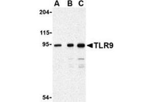 Western blot analysis of TLR9 in Jurkat cell lysate with this product at (A) 0. (TLR9 抗体  (Center))