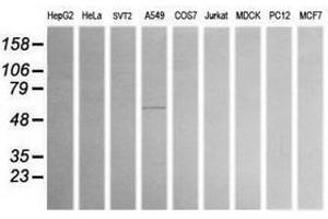 Image no. 1 for anti-Aldehyde Dehydrogenase 1 Family, Member A3 (ALDH1A3) (AA 1-100), (AA 413-512) antibody (ABIN1490536) (ALDH1A3 抗体  (AA 1-100, AA 413-512))