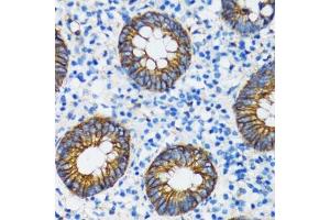 Immunohistochemistry (Paraffin-embedded Sections) (IHC (p)) image for anti-Catenin (Cadherin-Associated Protein), alpha 1, 102kDa (CTNNA1) (AA 637-906) antibody (ABIN6139202)