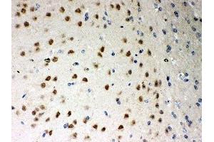 IHC-P: PKC iota antibody testing of mouse brain tissue (PKC iota 抗体  (AA 21-214))