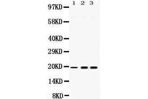 Western blot analysis of PC4 expression in rat liver extract ( Lane 1), HELA whole cell lysates ( Lane 2) and U2OS whole cell lysates ( Lane 3). (SUB1 抗体  (C-Term))