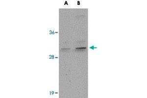 Western blot analysis of CENPO in mouse kidney tissue lysate with CENPO polyclonal antibody  at (A) 1 and (B) 2 ug/mL . (CENPO 抗体  (Internal Region))
