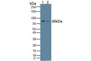 Figure. (PFKP 抗体  (AA 247-473))