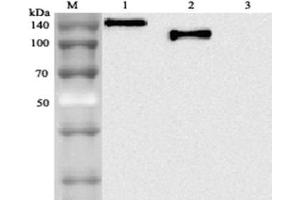 Western blot analysis using anti-ACE2 (human), mAb (AC18F) (Biotin)  at 1: 2,000 dilution.