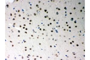 IHC testing of FFPE mouse brain with SF2 antibody. (SRSF1 抗体)