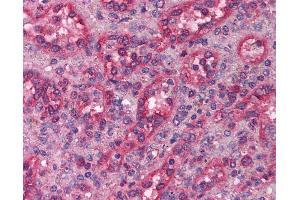 Anti-LHX1 antibody IHC of human spleen. (LHX1 抗体  (AA 120-169))