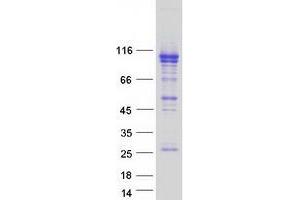 Western Blotting (WB) image for Oxysterol Binding Protein-Like 5 (OSBPL5) (Transcript Variant 3) protein (Myc-DYKDDDDK Tag) (ABIN2727990)