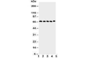 Western blot testing of COX2 antibody and Lane 1:  human placenta;  2: COLO320;  3: HeLa;  4: PANC;  5: SKOV cell lysate. (COX2 抗体  (AA 589-604))