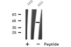 Western blot analysis of CYLC2 expression in A431 whole cell lysate ,The lane on the left is treated with the antigen-specific peptide. (CYLC2 抗体  (C-Term))