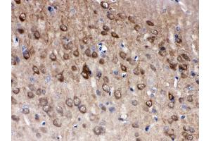 Anti- PGP9. (UCHL1 抗体  (C-Term))