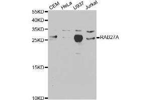 Western blot analysis of extracts of various cell lines, using RAB27A antibody (ABIN5970998) at 1/1000 dilution. (RAB27A 抗体)