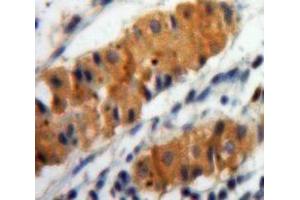 IHC-P analysis of Stomach tissue, with DAB staining. (ALOX15 抗体  (AA 170-312))