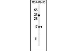 Western blot analysis in MDA-MB435 cell line lysates (35 ug/lane) using S100A1 Antibody (Center) Cat. (S100A1 抗体  (C-Term))