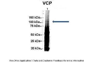 Amount and Sample Type : 500 ug Human NT2 cell lysate Amount of IP Antibody : 6 ug Primary Antibody : VCP Primary Antibody Dilution : 1:500 Secondary Antibody : Goat anti-rabbit Alexa-Fluor 594 Secondary Antibody Dilution : 1:5000 Gene Name : VCP Submitted by : Dr. (VCP 抗体  (C-Term))