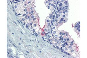 Anti-AMH antibody IHC of human prostate. (AMH 抗体  (AA 468-517))