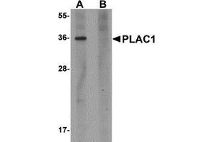 Western blot analysis of PLAC1 in human placenta tissue lysate with PLAC1 antibody at 1 μg/ml in (A) the absence and (B) the presence of blocking peptide.