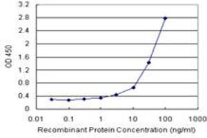 Sandwich ELISA detection sensitivity ranging from 0. (CPB1 (人) Matched Antibody Pair)