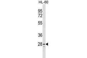 TLCD1 Antibody (C-term) western blot analysis in HL-60 cell line lysates (35 µg/lane). (TLCD1 抗体  (C-Term))