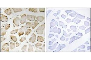 Immunohistochemistry analysis of paraffin-embedded human skeletal muscle tissue, using Arachidonate 5 Lipoxygenase (Ab-271) Antibody. (ALOX5 抗体  (AA 246-295))