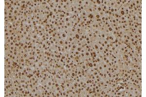 ABIN6277130 at 1/100 staining Mouse liver tissue by IHC-P.