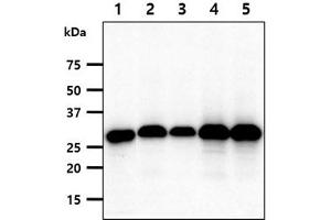 The cell lysates(40ug) were resolved by SDS-PAGE, transferred to PVDF membrane and probed with anti-human FHL2 antibody (1:1000). (FHL2 抗体)