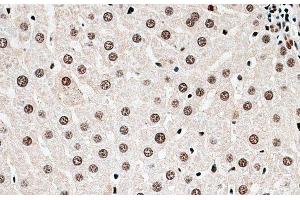 Immunohistochemistry of paraffin-embedded Rat liver using CBX6 Polyclonal Antibody at dilution of 1:100 (40x lens). (CBX6 抗体)