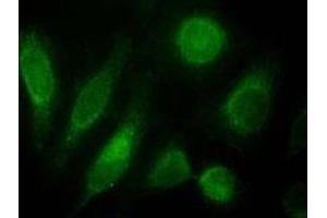 ODZ3 polyclonal antibody (Cat # PAB11565, 10 ug/mL) staining of nuclei HeLa cells (green). (TENM3 抗体)