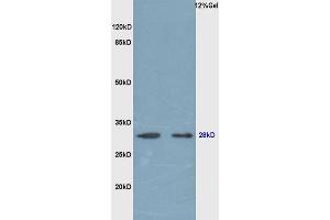 Rat lung lysates probed (ABIN679718) at 1:200 in 4 °C. (EPO 抗体  (AA 101-193))