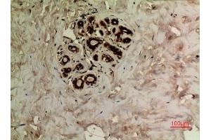 Immunohistochemical analysis of paraffin-embedded human-breast, antibody was diluted at 1:100. (alpha Tubulin 抗体  (acLys40))