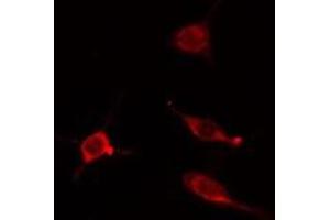 ABIN6275201 staining Hela cells by IF/ICC. (IQCB1 抗体  (Internal Region))