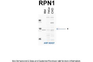 WB Suggested Anti-RPN1 Antibody Titration: 1 ug/mlPositive Control: HeLa and CHO-K1 cell lines, rouch canine microsomes (RPN1 抗体  (Middle Region))